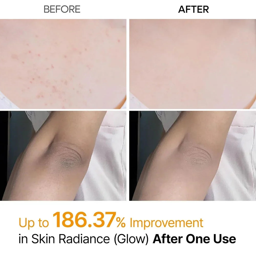 Dr. Melaxin Kojic Acid Turmeric Spray