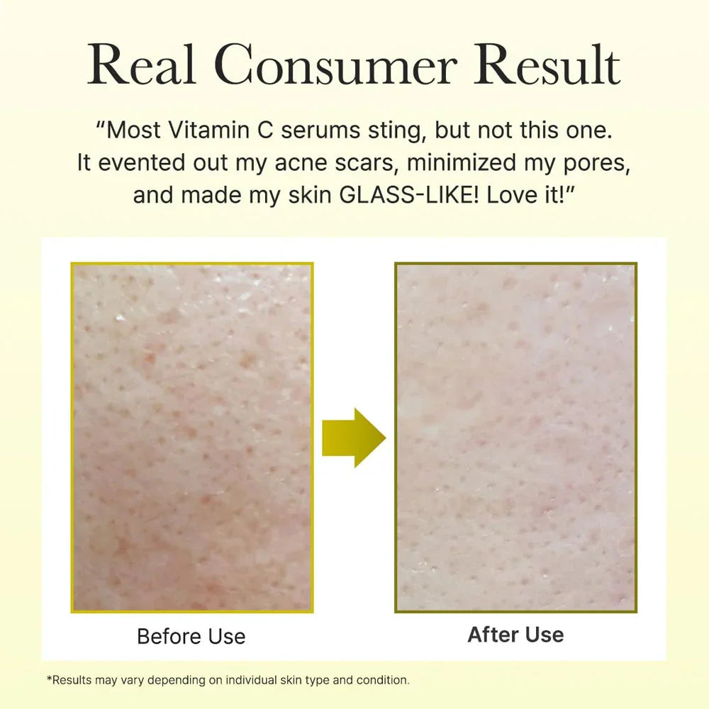Arencia Vitamin C Booster Shot 30ml (Limited Time offer buy 1 get 1 free)